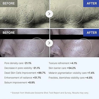 Micro Needle Exosome Shot and Collagen Jelly Cream